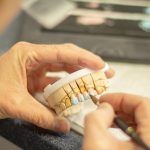 tooth-replacement-g89e3a0415_640